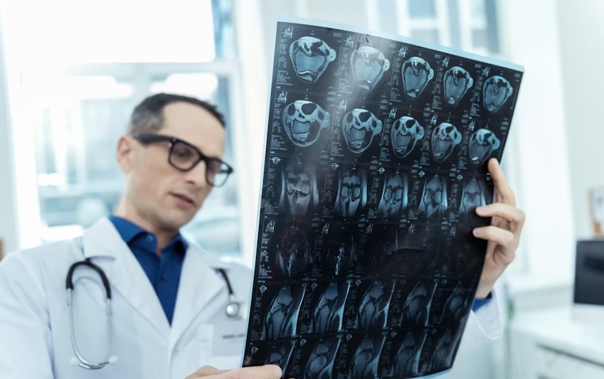 Best Hospitals In Texas For Neurosurgery.jpg